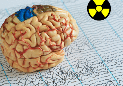 eeg-w-praktyce-klinicznej